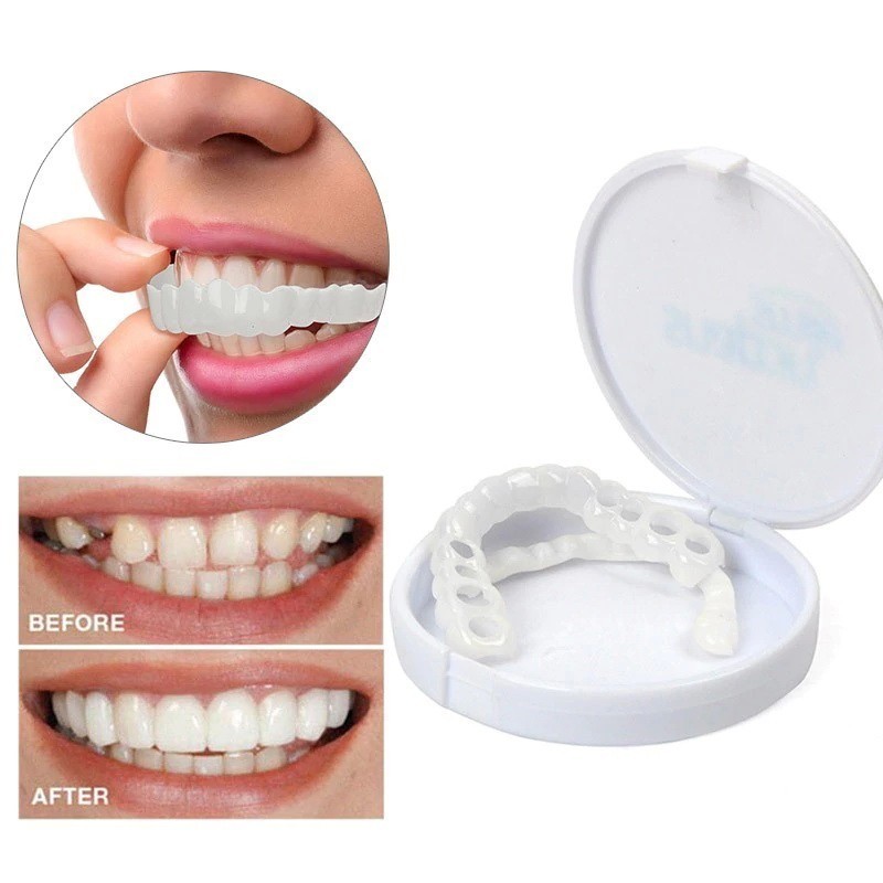 Виниры для эстетического протезирования зубов Snap On Smile от MELEON